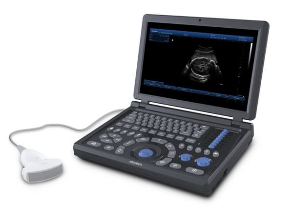 A15 Full Digital Laptop Ultrasonic Diagnostic System